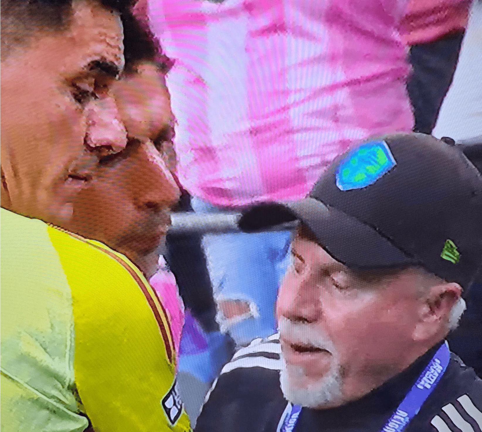 向对手吐口水!38岁苏亚雷斯被禁赛6场 受害者:我还以为他要咬我